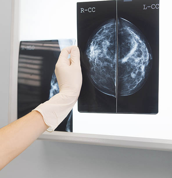 Imagen del curso Aplicación de la cirugía oncoreconstructiva en mujeres jóvenes con cáncer de mama para ganar autoestima